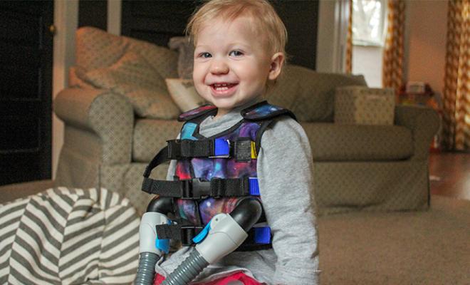 How My Perception of the Vest Changed | Cystic Fibrosis Foundation